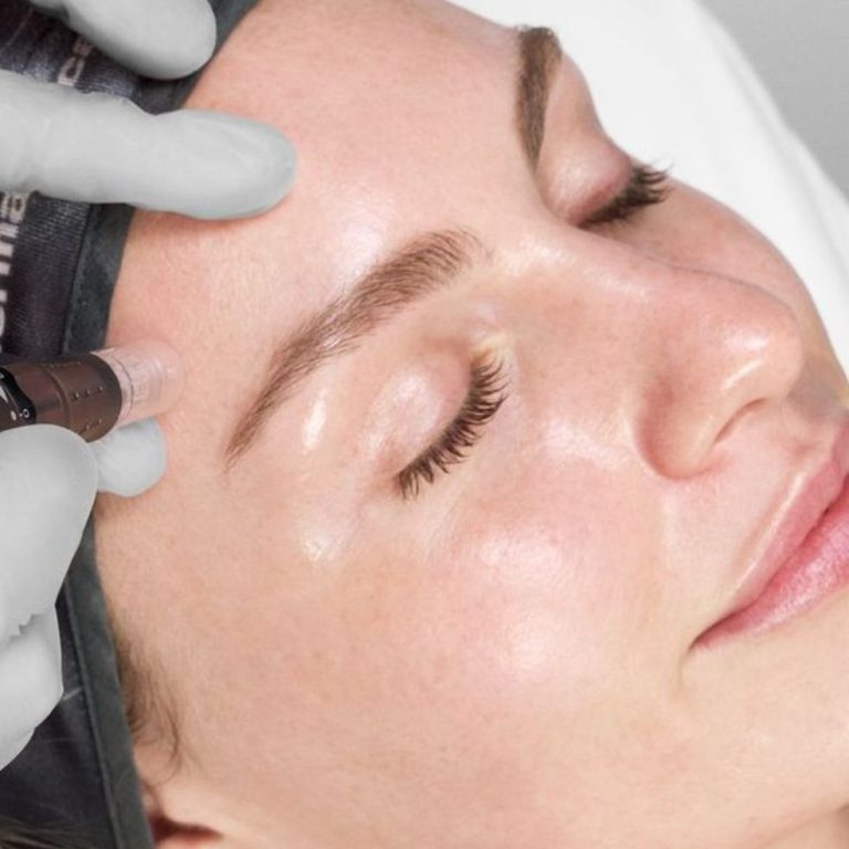 Exo Booster Microneedling hochwirksame Wirkstoffe- BeVe Beauty in Hanau