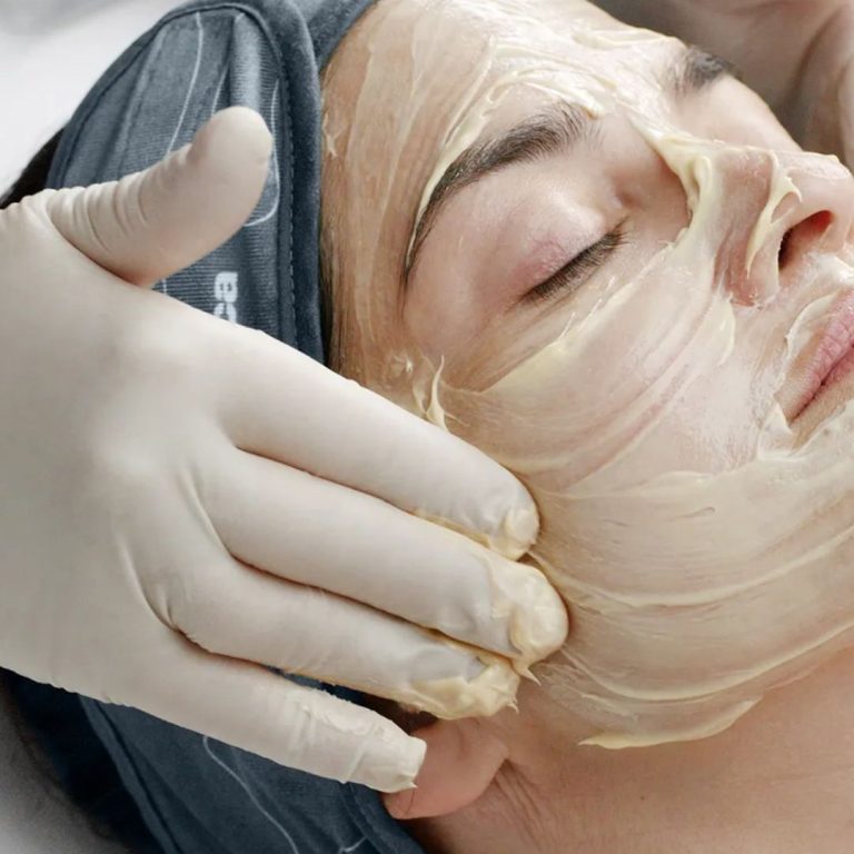 Gezielte Behandlung bei BeVe Beauty zur Reduktion von Hyperpigmentierung und ungleichmäßigem Hautton in Hanau.