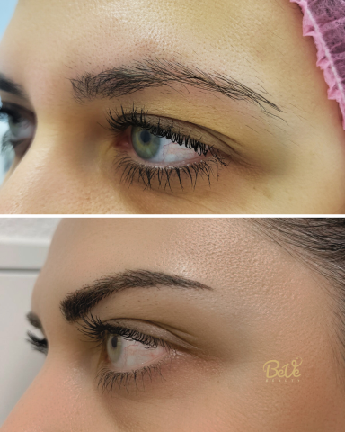 Vergleich von Augenbrauen vor und nach einem kosmetischen Eingriff, unterschiedliche Formen.