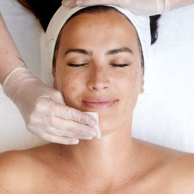 Fruchtsäure Behandlung in Hanau, die abgestorbene Hautzellen werden gelöst und die Hauterneuerung angeregt.