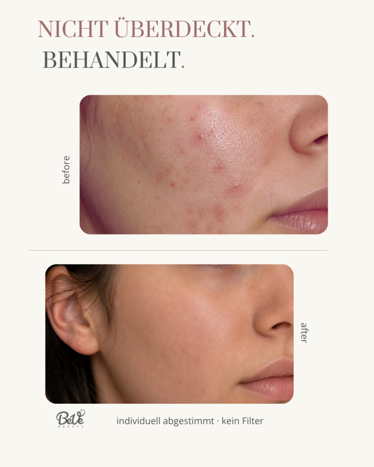 individuell abgestimmte Behandlungen in Hanau bei BeVe Beauty auf deine Haut
