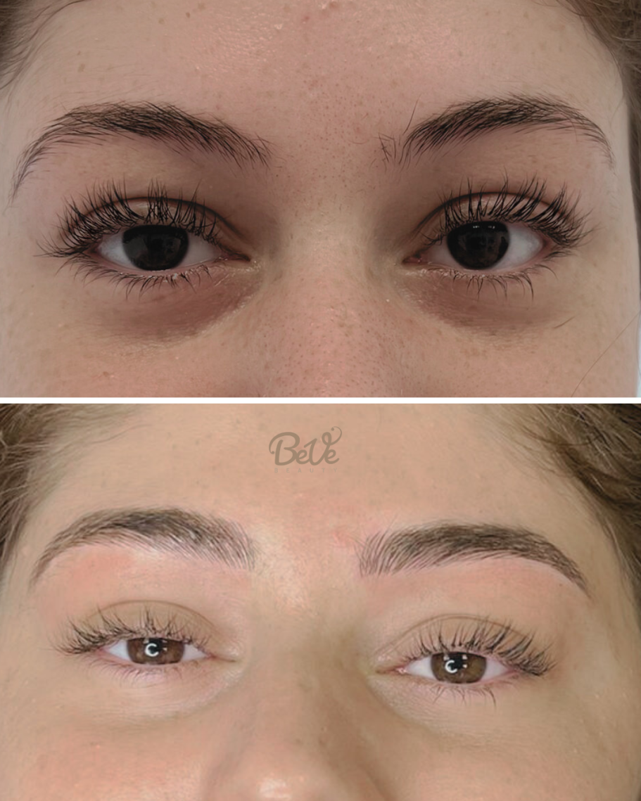 Vorher-Nachher-Vergleich von Augenbrauen nach Microblading bei Beve Beauty.
