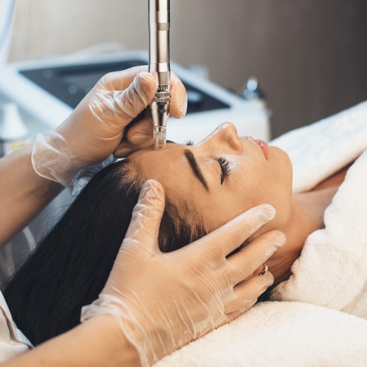 Microneedling für verschiedene Hauttypen geeignet