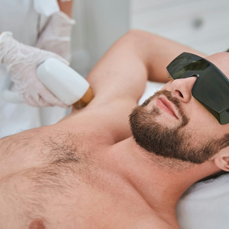 Mann mit Schutzbrille bei einer Behandlung zur Haarentfernung an der Achsel.