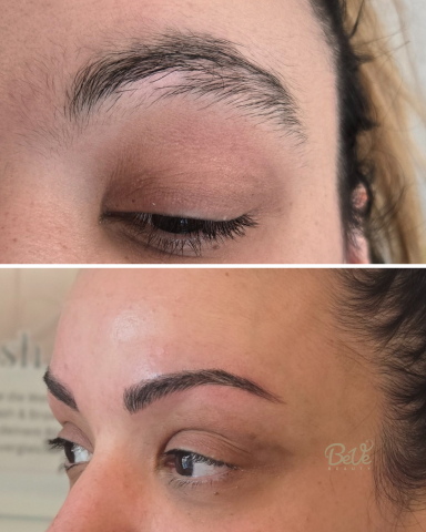 Vergleich von Augenbrauen vor und nach einer kosmetischen Behandlung.