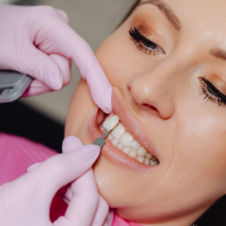 kosmetisches Zahnbleaching bei BeVe in Hanau mit sofort Effekt